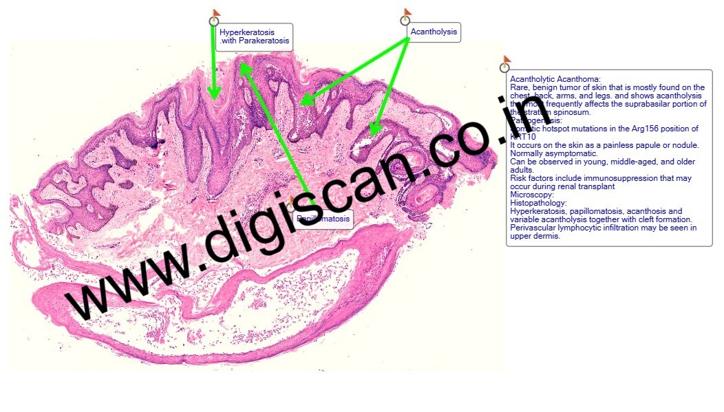 Dermatopathology Digital Slides Set (Skin Lesions, Infections & Tumors)